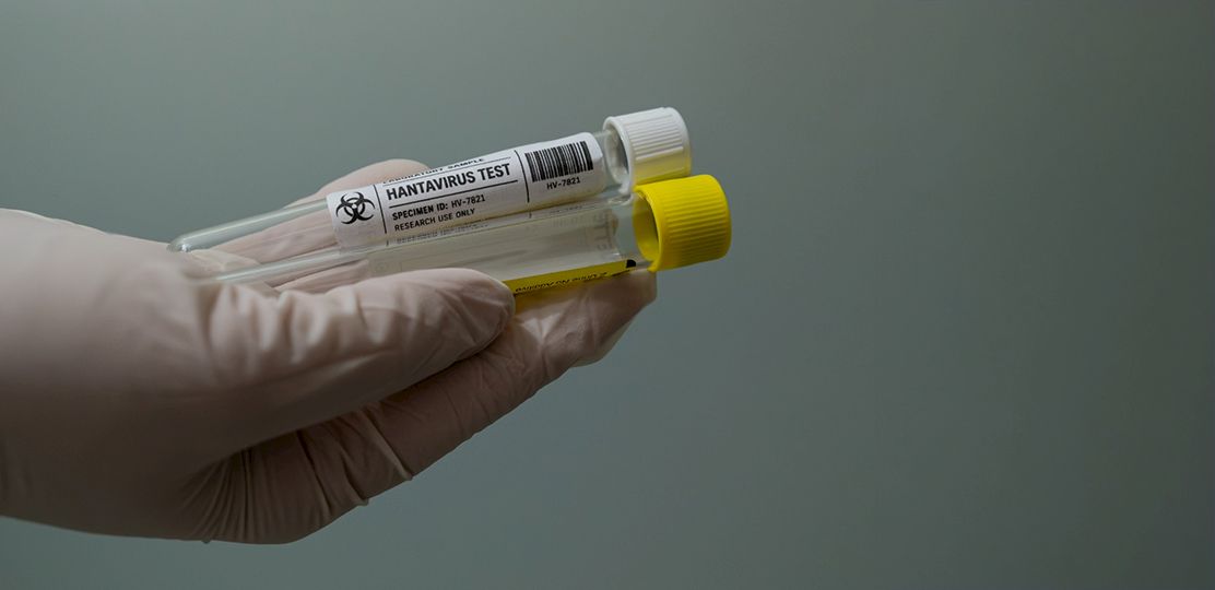 Tubos muestras test hantavirus