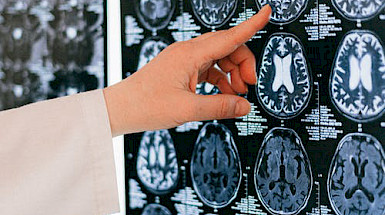imágenes del cerebro humano