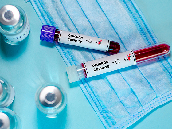 Frascos de exámenes con variante ómicron