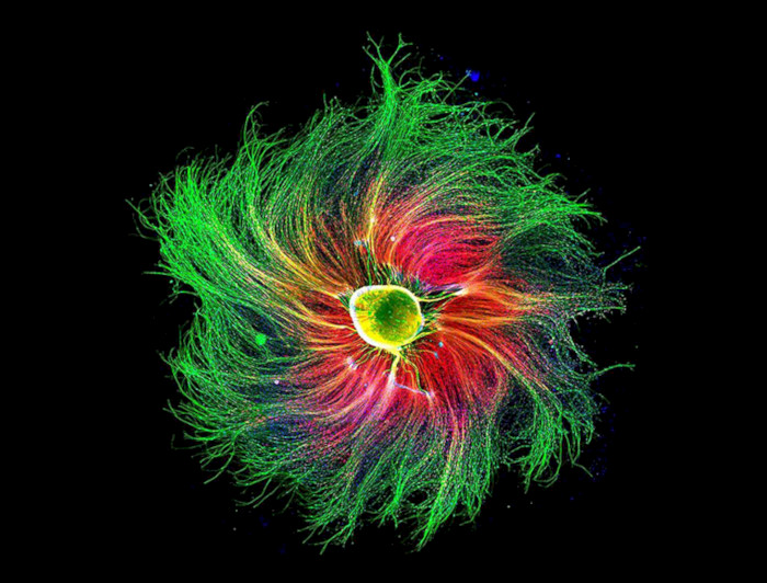 Detalle al microscopio de células neuronales, con muchos colores
