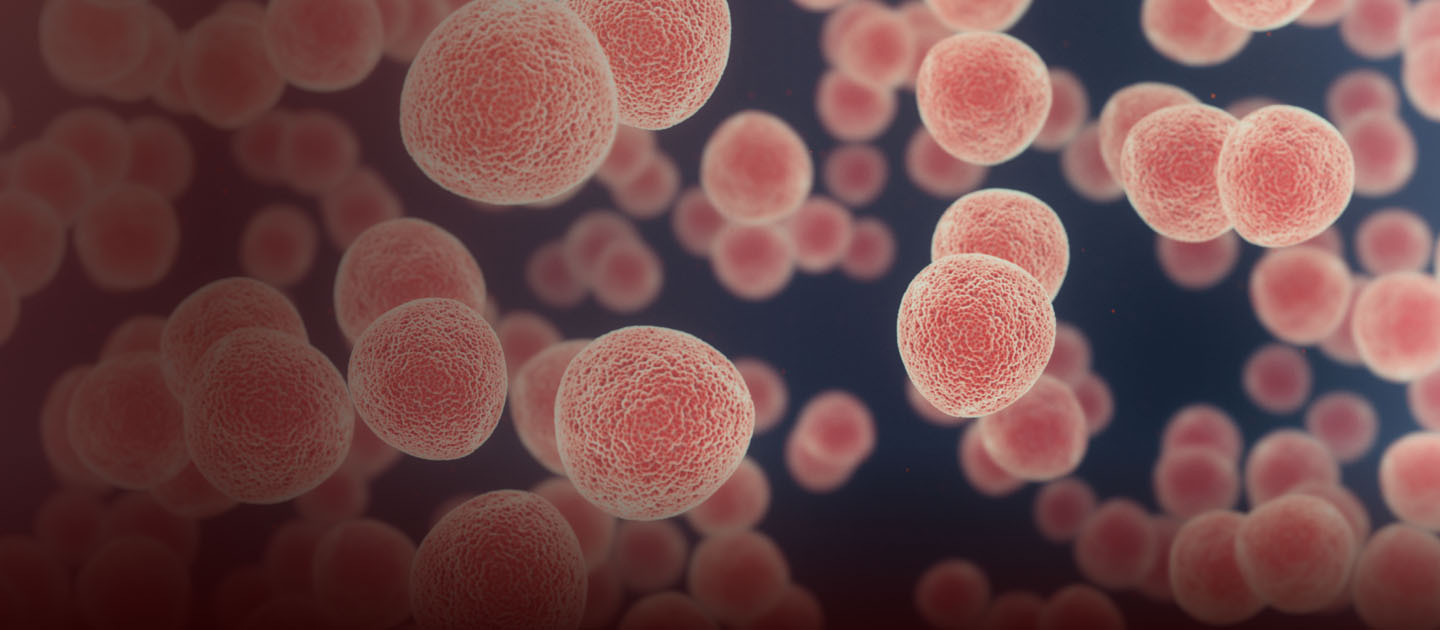 Imagen de células cancerígenas en color rojizo con fondo azul