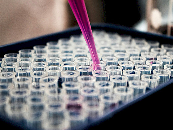 Detalle de pipeta dispensando líquido en tubos para análisis científico.