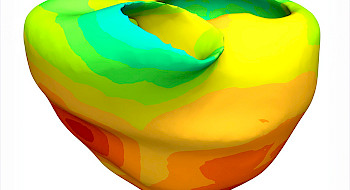 Figura red de Purkinje