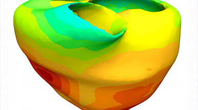Figura red de Purkinje