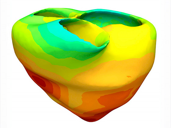 Figura red de Purkinje