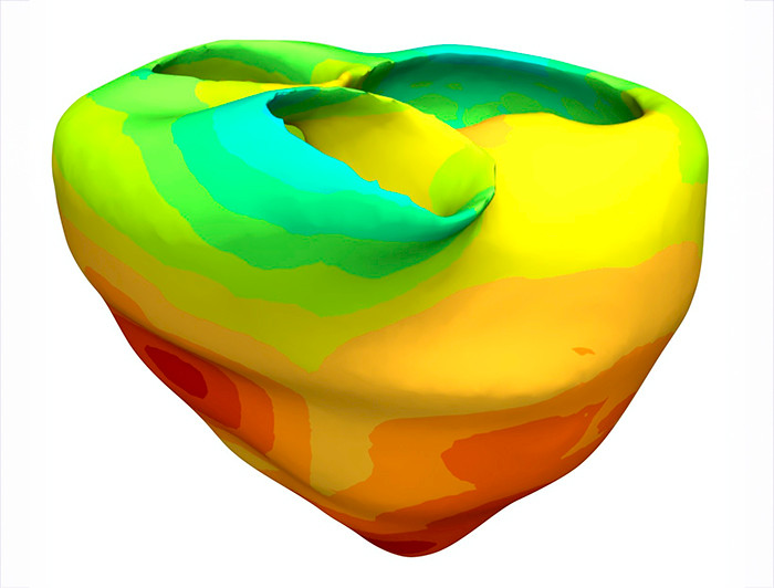Figura red de Purkinje