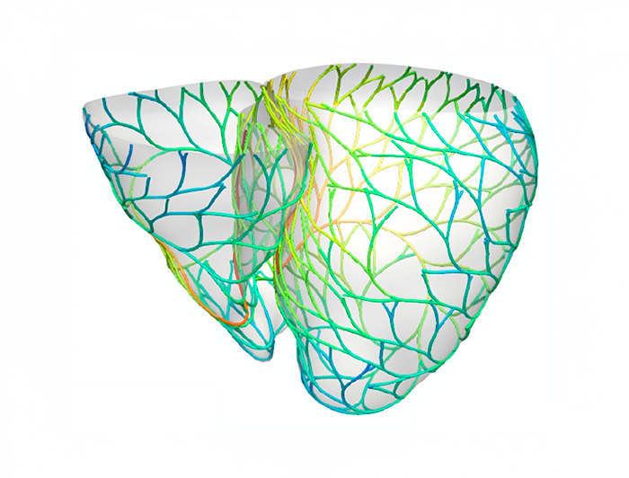 Simulación red de Purkinje.