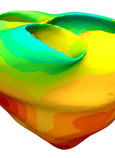 The Purkinje network