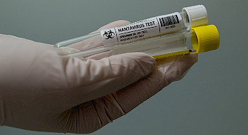 Tubos muestras test hantavisrus