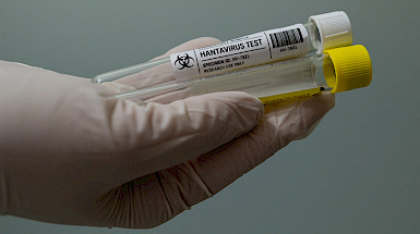 Tubos muestras test hantavisrus