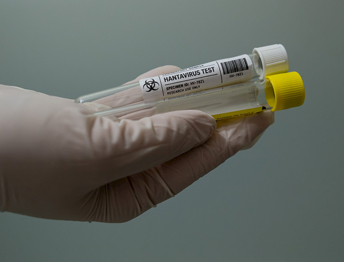 Tubos muestras test hantavisrus