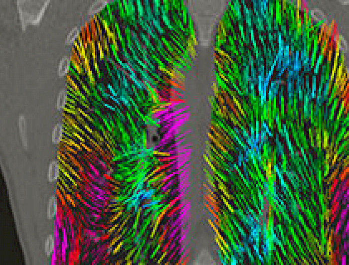 imagen correspondiente a la noticia: "Crean tecnología 3D para adelantar diagnóstico de enfermedades pulmonares"