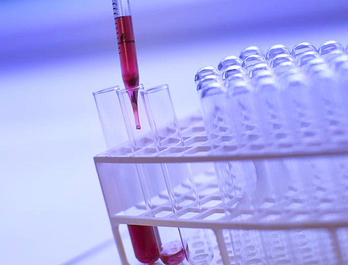 De acuerdo a Pilar Carvallo, este test podría tener un costo significativamente más bajo -utilizando la técnica PCR- lo que permitirá llegar con esta innovación a más personas. (Fotografía: Pixabay)